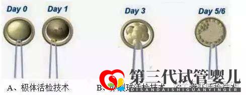 三代試管知男女的必經(jīng)之路—胚胎活檢術(shù)(圖1)