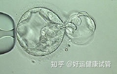 三代試管知男女的必經(jīng)之路—胚胎活檢術(shù)(圖4)
