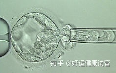 三代試管知男女的必經(jīng)之路—胚胎活檢術(shù)(圖5)