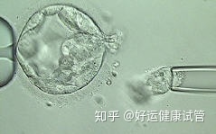 三代試管知男女的必經(jīng)之路—胚胎活檢術(shù)(圖6)