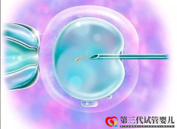 通俗易懂的一、二、三代試管嬰兒解說(圖2)