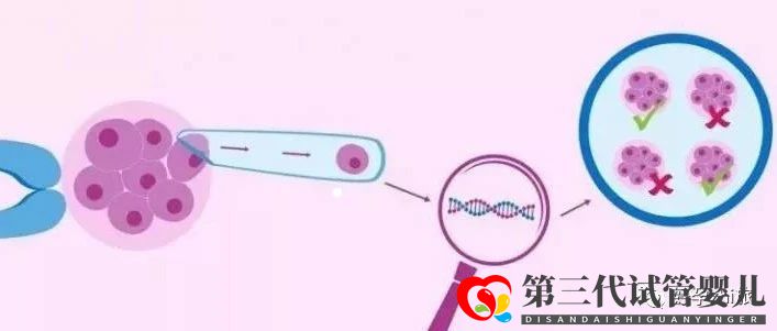 通俗易懂的一、二、三代試管嬰兒解說(圖4)