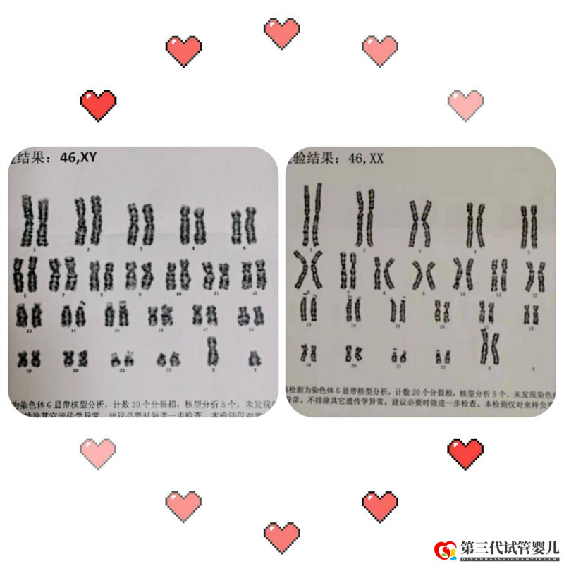 為什么父母染色體正常，胚胎染色體卻有問(wèn)題？(圖1)