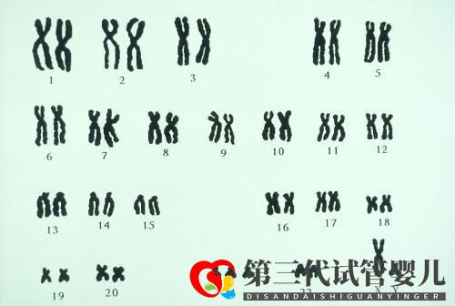 夫妻染色體正常，試管胚胎染色體異常的三個原因你都知道嗎？(圖2)