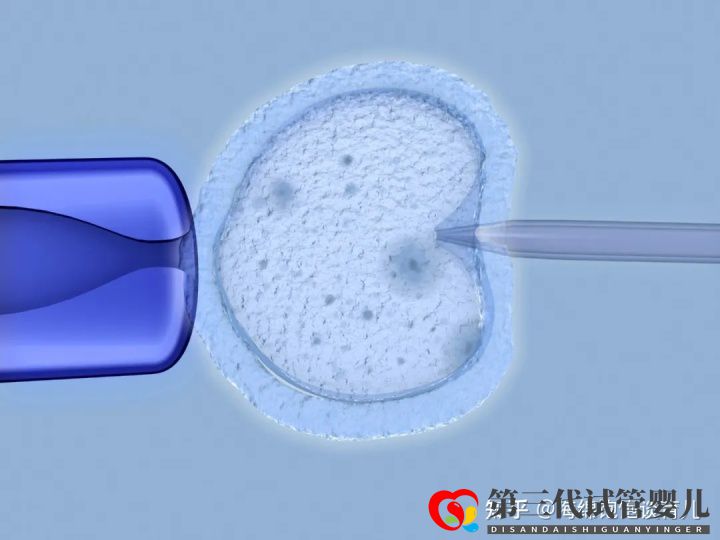 試管嬰兒1代、2代、3代、4代哪個最好真實操作過...(圖11) 試管嬰兒1代、2代、3代、4代哪個最好真實操作過...(圖11)