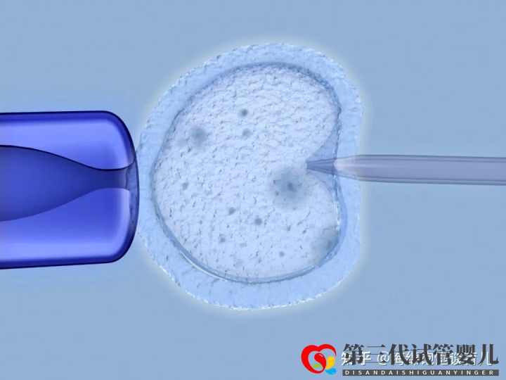 試管嬰兒1代、2代、3代、4代哪個最好真實操作過...(圖12) 試管嬰兒1代、2代、3代、4代哪個最好真實操作過...(圖12)