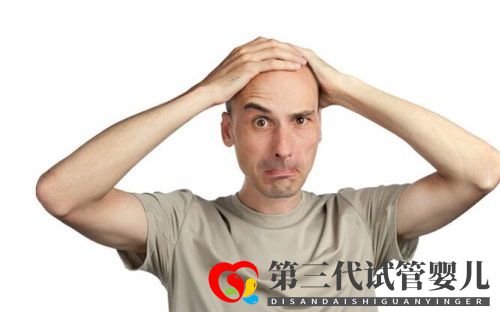 種植頭發可以解決額頭頭發少的問題嗎？(圖2)