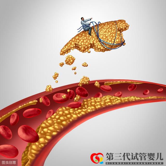 頸動脈斑塊篩查，能降低心腦血管事件發生嗎？(圖2)