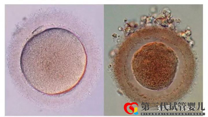 高齡女性試管多次失敗,應該何去何從(圖1)