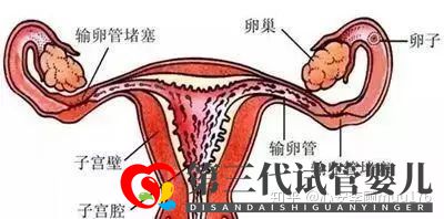 人工授精跟試管嬰兒的區別(圖3)