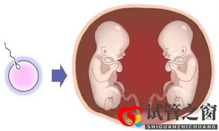 做試管嬰兒，一次移植兩個生雙胞胎好不好？(圖3)