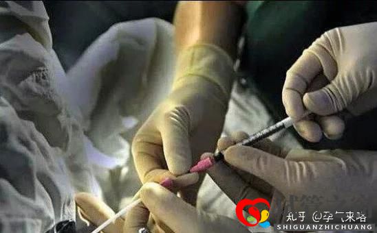 直擊試管嬰兒的過程(圖2)
