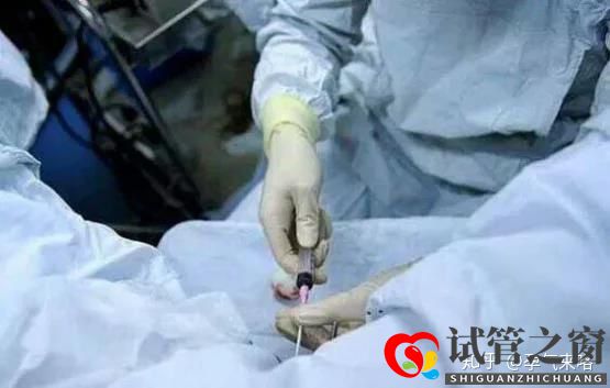 直擊試管嬰兒的過程(圖6)
