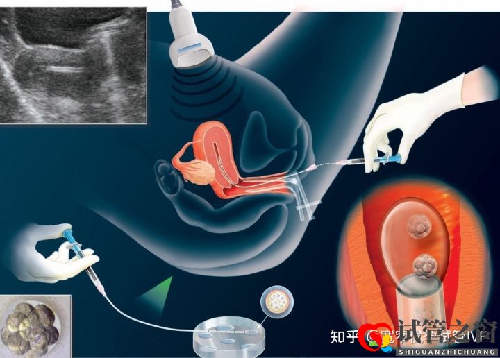 重慶哪里可以做試管嬰兒供卵供卵需要多少錢(圖4) 重慶哪里可以做試管嬰兒供卵供卵需要多少錢(圖4)