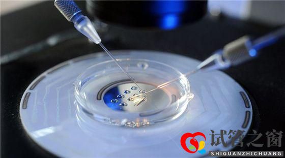 多囊卵巢綜合癥能做試管嬰兒嗎(圖1) 多囊卵巢綜合癥能做試管嬰兒嗎(圖1)