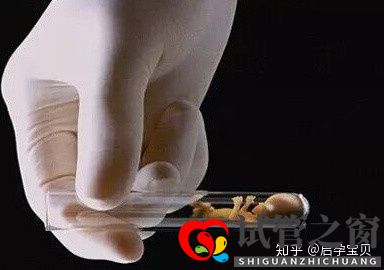靠試管嬰兒生寶寶首先要滿足6個標準(試管嬰兒怎么做的全過程)(圖1) 靠試管嬰兒生寶寶首先要滿足6個標準(試管嬰兒怎么做的全過程)(圖1)
