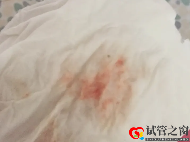 取卵后出現(xiàn)少量出血為正常現(xiàn)象