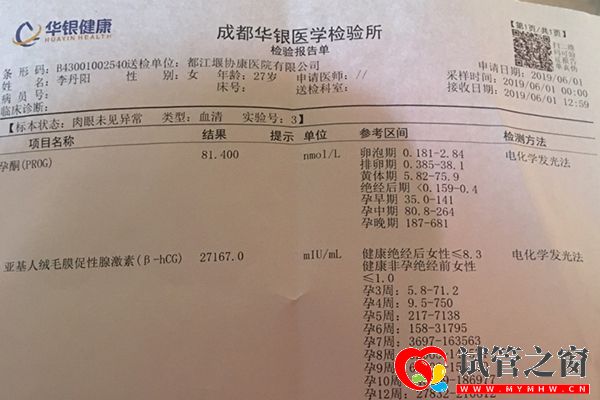 女性驗孕檢驗報告單