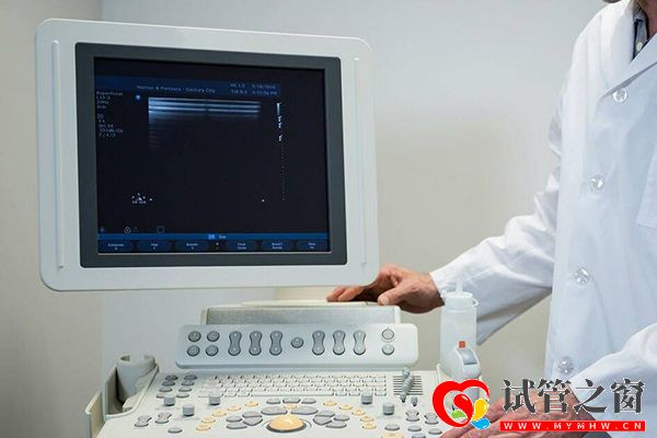 試管移植后超聲檢查胎兒發育情況