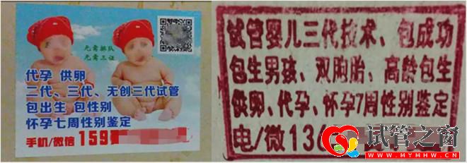 性別鑒定、包生男女三代試管「亂象」緣何產生(圖5)