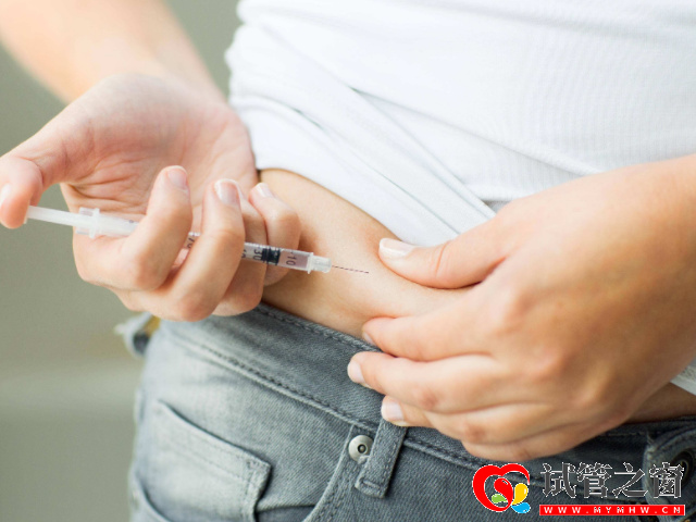 試管促排卵費用在一直兩萬元左右