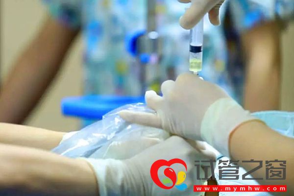 8號染色體短臂缺失后果嚴(yán)重