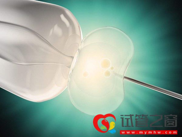 趁年齡小做試管可預(yù)防空卵泡