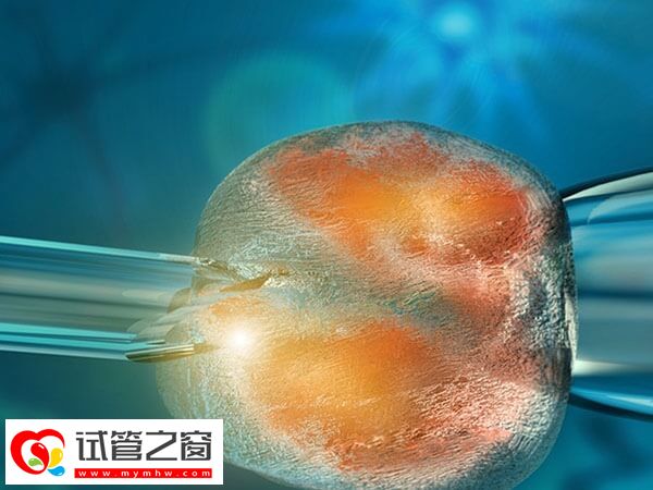 不打麻藥取卵會不會很難受
