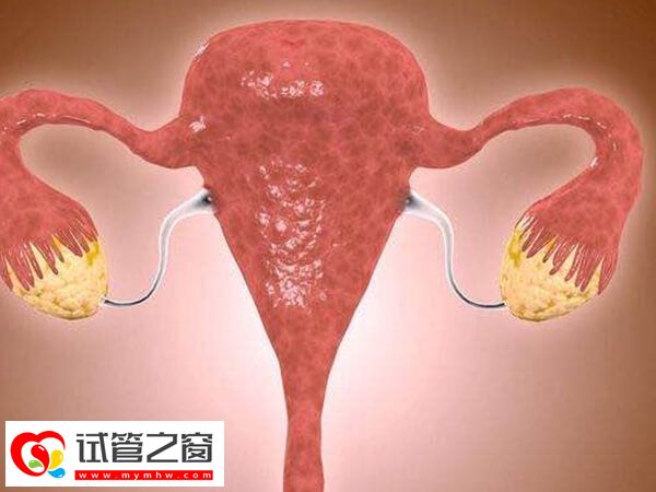 子宮內膜異位有哪些表現
