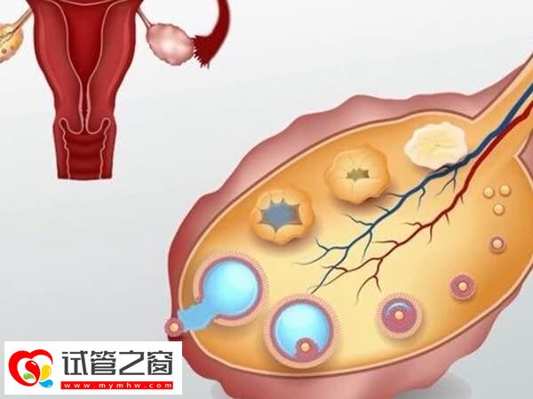 單角子宮做試管成功率如何
