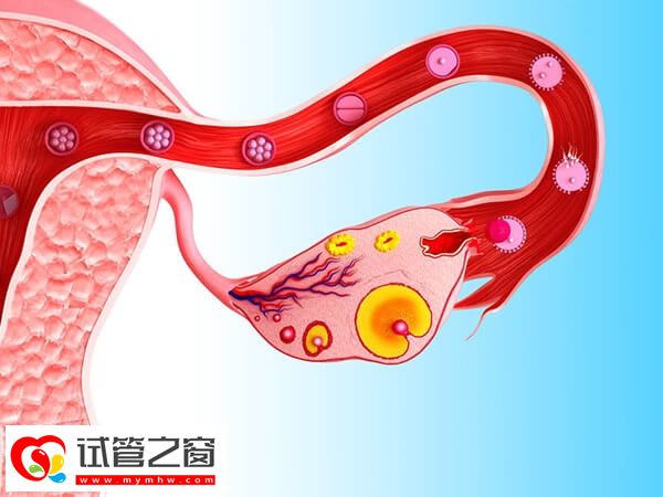 女性子宮肌瘤有哪些癥狀