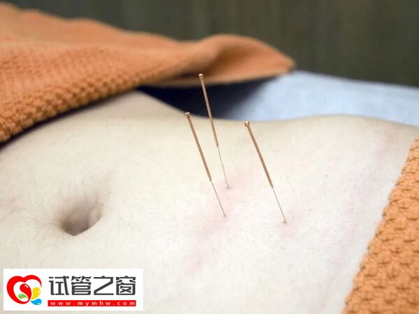 針灸可以調和陰陽