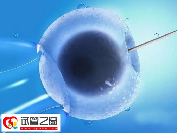 三代試管嬰兒能避免遺傳疾病