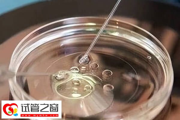妊娠高風險的患者不建議懷雙胎