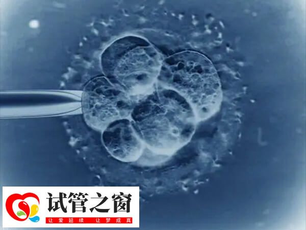 試管嬰兒短方案用藥時間短