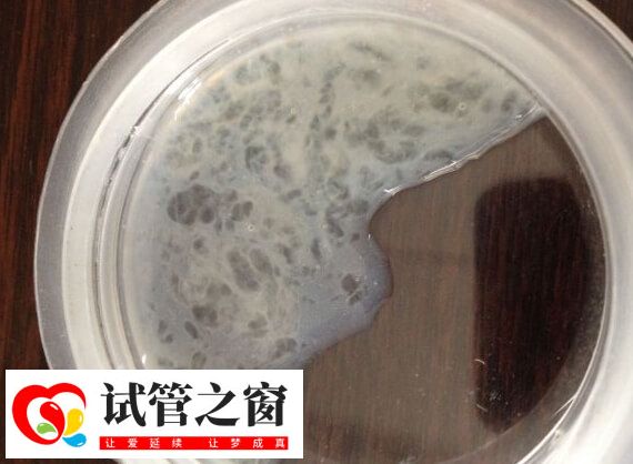 精子活力三級是精子直線前進