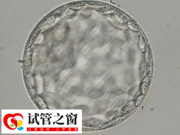 胚胎質量一般也是可以移植的