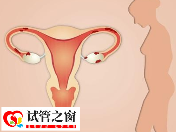 子宮內膜厚度均勻正常