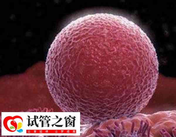 泰國試管嬰兒多胎妊娠容易引發早產
