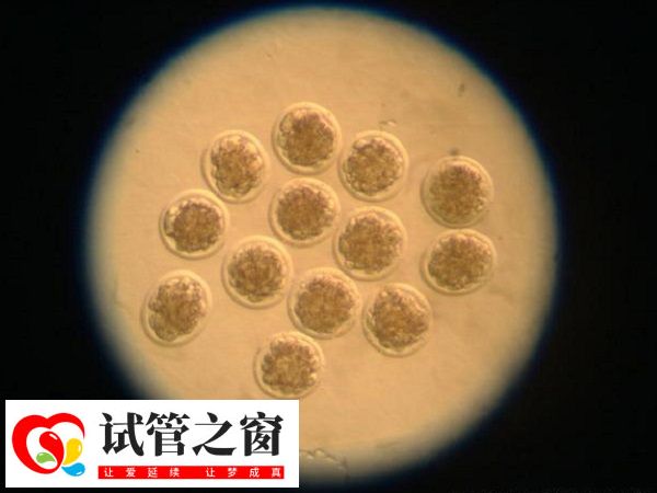 胚胎的等級評估主要依據(jù)胚胎的發(fā)育階段