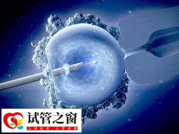 胚胎移植這一步是最后的關鍵一步