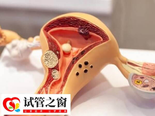 試管嬰兒移植后肚子疼是常見的反應