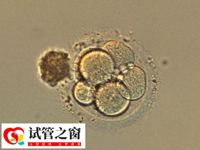 囊胚質量的數字代表發育快慢