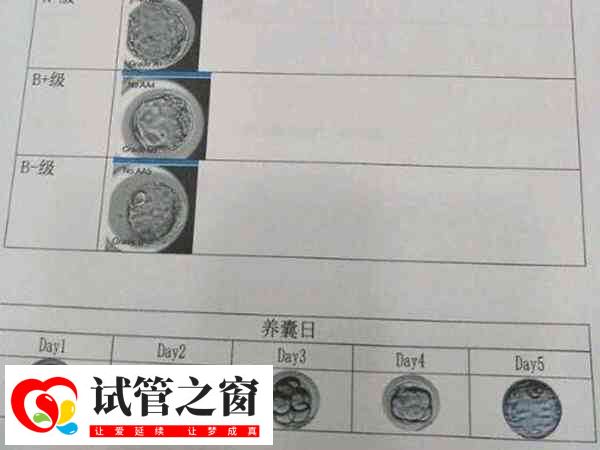 囊胚和冷凍囊胚區別不大