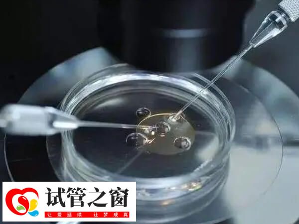 試管嬰兒就是將精子和卵子拿到體外結合