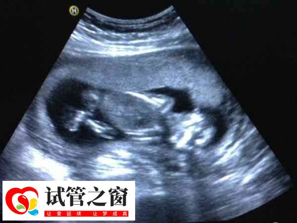試管打夜針是一種促進排卵的方式