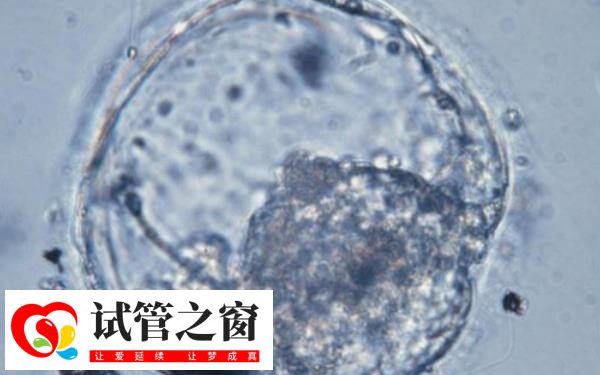 4cb囊胚確實屬于等級偏低的胚胎