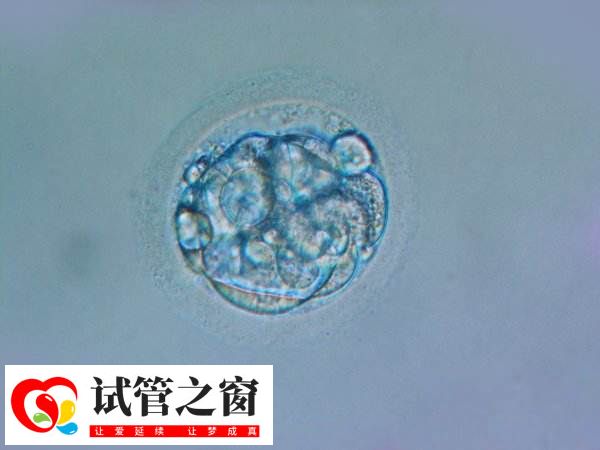 試管移植后會(huì)出現(xiàn)一些癥狀表現(xiàn)
