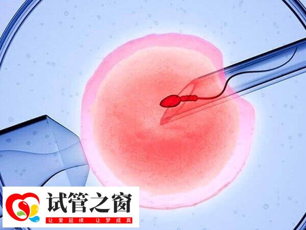 第四代試管技術(shù)研究方向