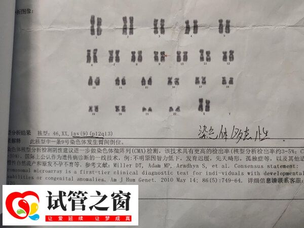 9號(hào)染色體是人類(lèi)的23對(duì)染色體之一